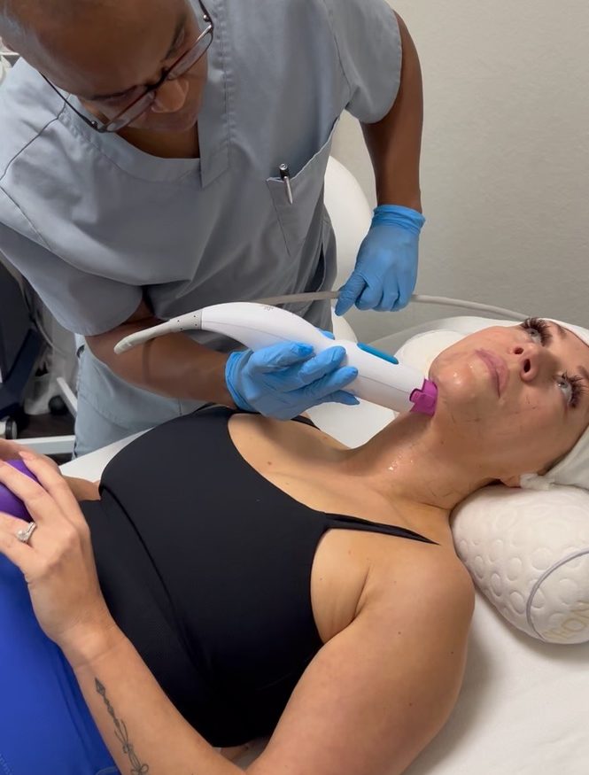Steve Cornelius treating a guest's jawline with the Thermage FLX handpiece